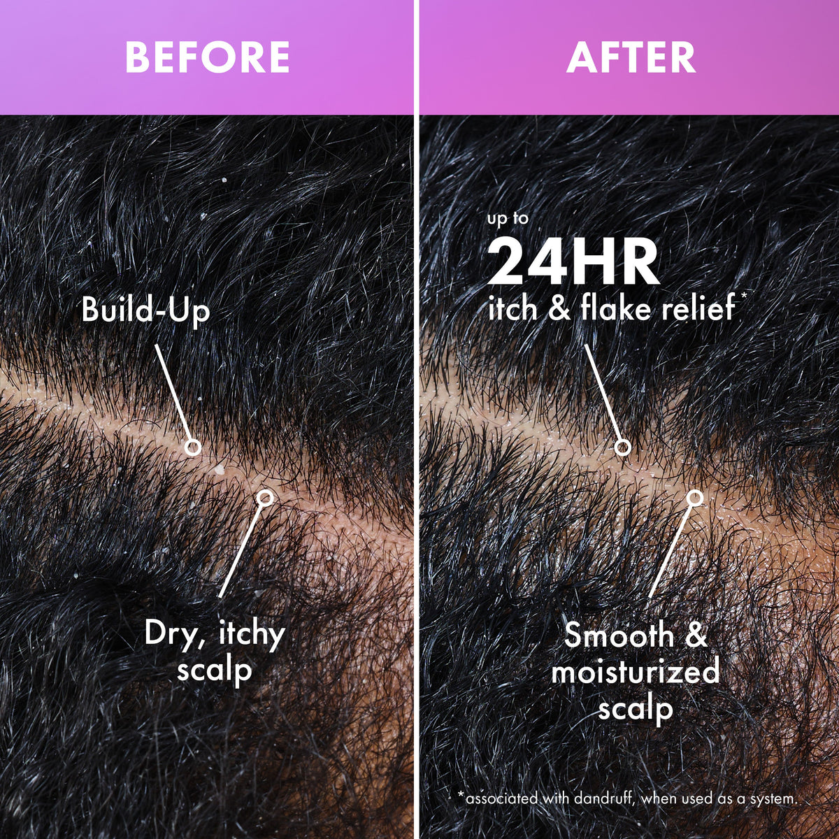 Lavender & Lychee Daily Scalp Moisturizing Lotion